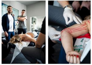 Curs acupunctură musculară (dry needling) în București, la MedBoost Academy – aplicabil imediat în cabinet